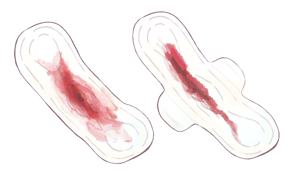 中絶後の出血はどのようなものですか?