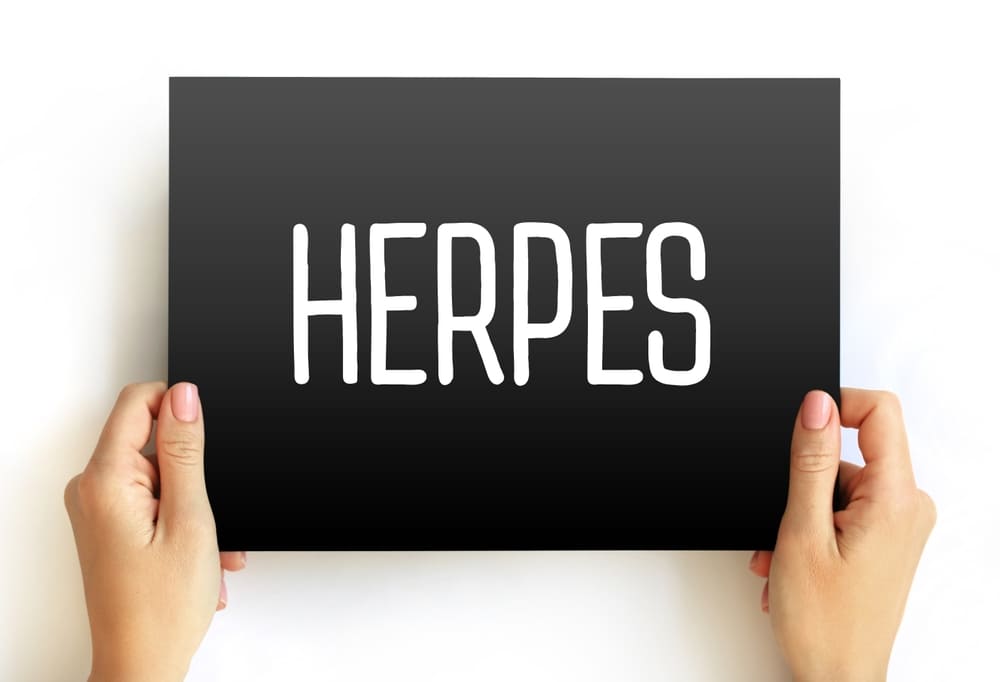 ヘルペスの症状｜予防法や治療方法についても解説