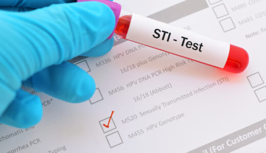 梅毒の検査はいつからできる？検査費用や治療法についても解説