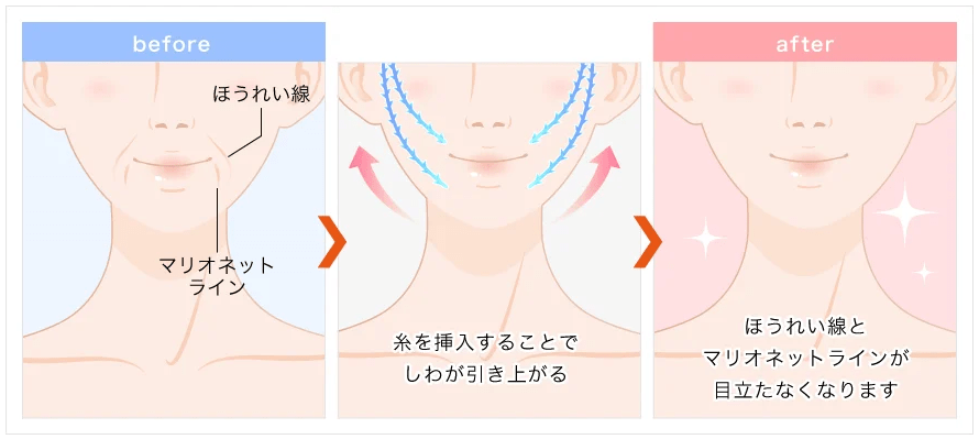 TCB東京中央美容外科