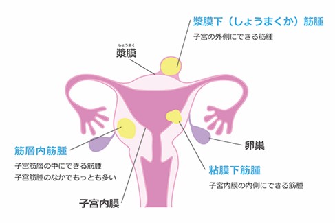 生理痛の症状がひどいときはどうしたらいい 原因と対処法 病院に行く目安